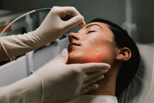 Endolift Endolaser Laserlift Endolipolyse Laserlipolyse Laserfaser Minimalinvasiv