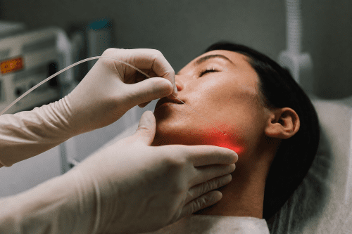 Endolift Endolaser Laserlift Endolipolyse Laserlipolyse Laserfaser Minimalinvasiv