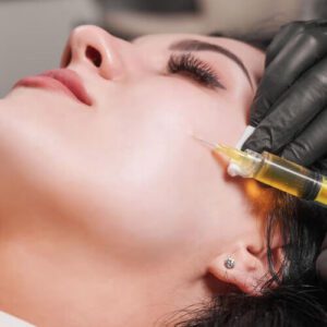 PRP Eigenblutbehandlung auch bekannt als Flüssiges Gold für strahlende Teint, Hautelastizität und eine jugendliche Ausstrahlung in Stuttgart