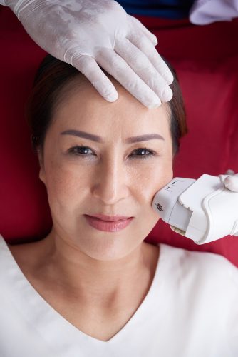 HIFU Gesicht & Körper